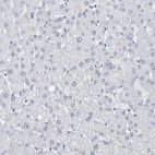 Immunohistochemical staining of human liver shows no positivity in hepatocytes as expected.