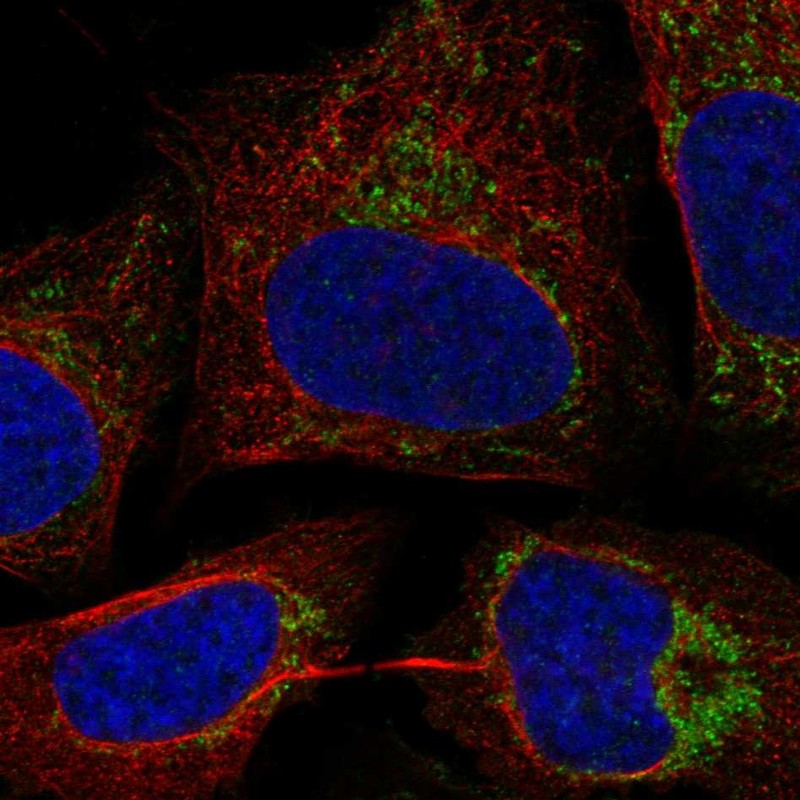 Anti-C17orf80 Antibody