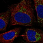 Anti-C17orf80 Antibody