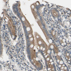 Anti-CDCP1 Antibody