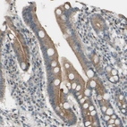 Immunohistochemical staining of human duodenum shows moderate membranous positivity in glandular cells.