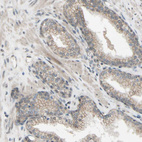 Anti-CDCP1 Antibody