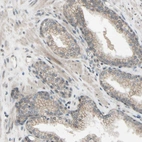 Immunohistochemical staining of human prostate shows moderate membranous positivity in glandular cells.