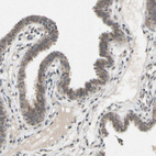 Anti-CDCP1 Antibody