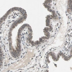 Immunohistochemical staining of human Fallopian tube shows moderate membranous positivity in glandular cells.