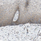 Immunohistochemical staining of human cervix shows weak to moderate membranous positivity in squamous epithelial cells.