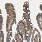 Immunohistochemical staining of human duodenum shows strong membranous positivity in glandular cells.