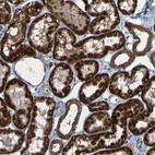 Immunohistochemical staining of human kidney shows strong granular cytoplasmic positivity in cells in tubules.