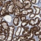 Immunohistochemical staining of human kidney shows strong granular cytoplasmic positivity in cells in tubules.