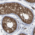 Immunohistochemical staining of human testis shows strong granular cytoplasmic positivity in cells in seminiferous ducts.