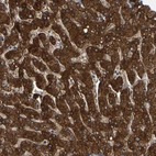Immunohistochemical staining of human liver shows strong granular cytoplasmic positivity in hepatocytes.