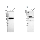 Western blot analysis using Anti-CCDC51 antibody HPA010980 (A) shows similar pattern to independent antibody HPA011408 (B).