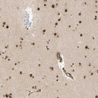 Anti-ZMYM6 Antibody