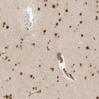 Anti-ZMYM6 Antibody