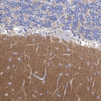 Anti-SYT12 Antibody
