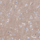 Immunohistochemical staining of human cerebral cortex shows moderate cytoplasmic positivity in neuropil.