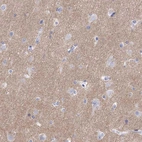 Immunohistochemical staining of human cerebral cortex shows moderate cytoplasmic positivity in neuropil.