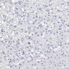 Immunohistochemical staining of human liver shows very weak cytoplasmic positivity in hepatocytes.