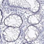 Immunohistochemical staining of human rectum shows no positivity in glandular cells as expected.