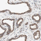 Immunohistochemical staining of human prostate shows strong positivity in Golgi apparatus in glandular cells.