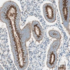 Immunohistochemical staining of human endometrium shows strong positivity in Golgi apparatus in glandular cells.