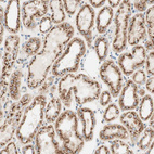 Immunohistochemical staining of human kidney shows strong positivity in Golgi apparatus in cells in tubules.