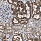 Anti-GLIPR1 Antibody