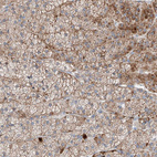 Anti-MRAP Antibody