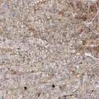 Anti-MRAP Antibody