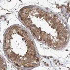 Immunohistochemical staining of human testis shows moderate cytoplasmic positivity in cells in seminiferous ducts.