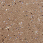 Immunohistochemical staining of human cerebral cortex shows moderate cytoplasmic positivity in neurons.