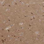 Immunohistochemical staining of human cerebral cortex shows moderate cytoplasmic positivity in neurons.