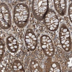 Immunohistochemical staining of human colon shows moderate cytoplasmic positivity in glandular cells.