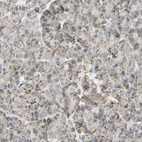 Anti-LETM1 Antibody