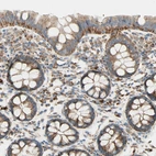 Immunohistochemical staining of human colon shows moderate to strong granular cytoplasmic positivity in glandular cells.