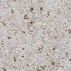 Immunohistochemical staining of human cerebral cortex shows strong granular cytoplasmic positivity in neurons.