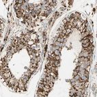 Immunohistochemical staining of human testis shows strong granular cytoplasmic positivity in cells in seminiferous ducts.