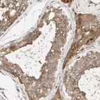 Anti-NECTIN3 Antibody