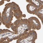 Immunohistochemical staining of human placenta shows strong cytoplasmic positivity in trophoblastic cells.