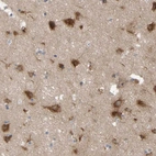 Immunohistochemical staining of human cerebral cortex shows strong cytoplasmic positivity in neurons.