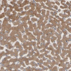 Immunohistochemical staining of human liver shows strong cytoplasmic positivity in hepatocytes.