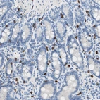 Anti-CEACAM1 Antibody