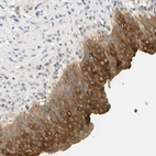 Anti-C2CD2L Antibody
