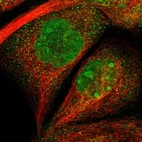 Immunofluorescent staining of human cell line A-431 shows localization to nucleus, nucleoli, nuclear membrane & cytosol.