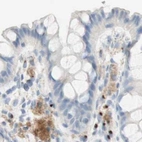 Immunohistochemical staining of human colon using Anti-MANEA antibody HPA011046.