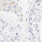 Immunohistochemical staining of human testis using Anti-MANEA antibody HPA011046.