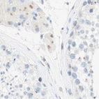 Immunohistochemical staining of human testis using Anti-MANEA antibody HPA011046.