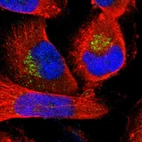 Immunofluorescent staining of human cell line U-251 MG shows localization to the Golgi apparatus.