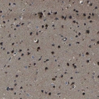 Immunohistochemical staining of human cerebral cortex shows strong cytoplasmic positivity in neuronal cells.