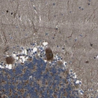 Immunohistochemical staining of human cerebellum shows strong cytoplasmic positivity in Purkinje cells.